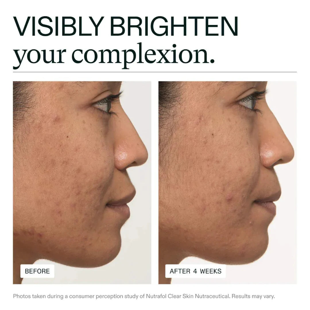 Before and after comparison of a woman's face with text 'Visibly Brighten your complexion' and 'After 4 Weeks'.