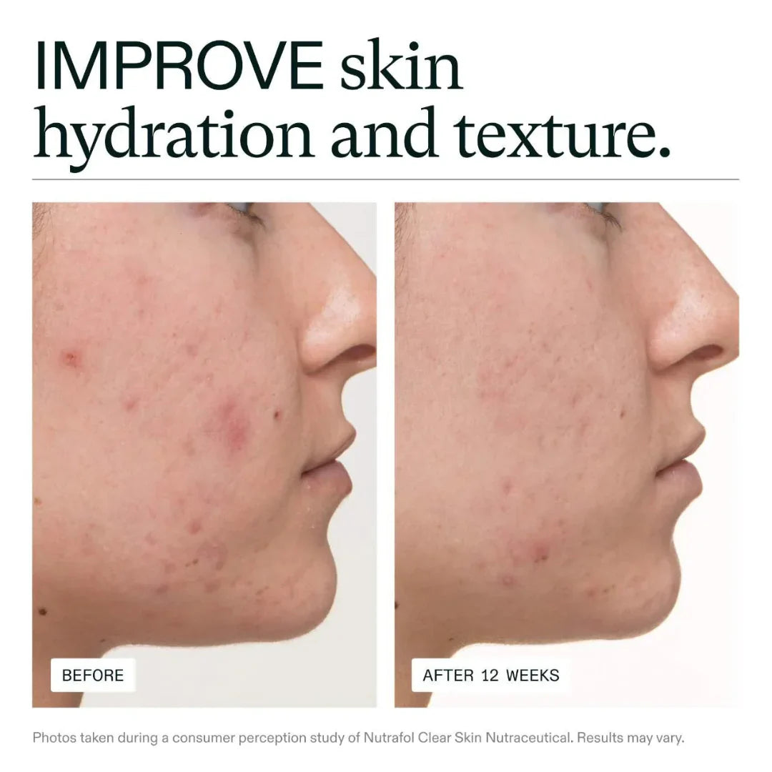 Before and after comparison of skin hydration and texture with text 'IMPROVE skin hydration and texture'.